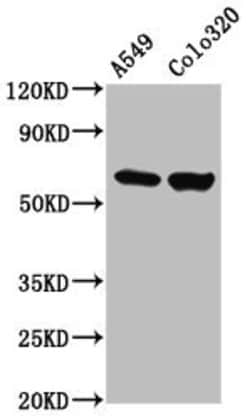 Invitrogen PDILT Polyclonal Antibody 100 &mu;g; Unconjugated:Antibodies,