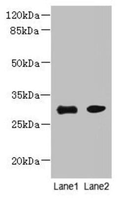 Invitrogen PI4KAP1 Polyclonal Antibody 100 μg; Unconjugated:Antibodies,