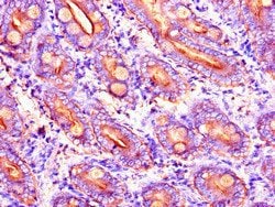 Invitrogen DYNC2H1 Polyclonal Antibody 100 &mu;g; Unconjugated:Antibodies,