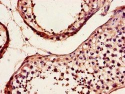 Invitrogen DYNC2H1 Polyclonal Antibody 100 &mu;g; Unconjugated:Antibodies,