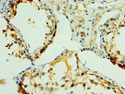 Invitrogen NLGN4Y Polyclonal Antibody 100 &mu;L; Unconjugated:Antibodies,
