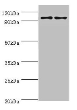 Invitrogen NLGN4Y Polyclonal Antibody 100 &mu;L; Unconjugated:Antibodies,