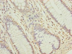 Invitrogen NUBPL Polyclonal Antibody 100 μg; Unconjugated:Antibodies,