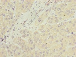 Invitrogen NUBPL Polyclonal Antibody 100 μg; Unconjugated:Antibodies,