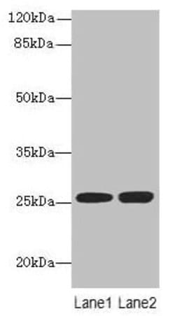 Invitrogen N6AMT2 Polyclonal Antibody 100 &mu;g; Unconjugated:Antibodies,