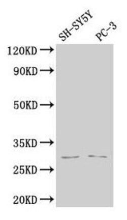 Invitrogen APH1B Polyclonal Antibody 100 &mu;L; Unconjugated:Antibodies,