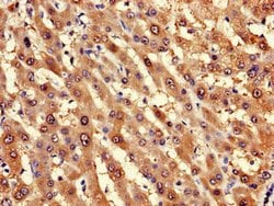 Invitrogen LPGAT1 Polyclonal Antibody 100 &mu;g; Unconjugated:Antibodies,