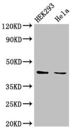 Invitrogen LPGAT1 Polyclonal Antibody 100 &mu;g; Unconjugated:Antibodies,