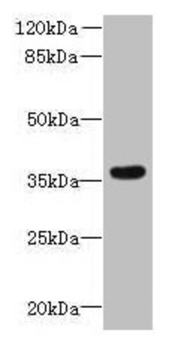 Invitrogen ZDHHC12 Polyclonal Antibody 100 &mu;g; Unconjugated:Antibodies,
