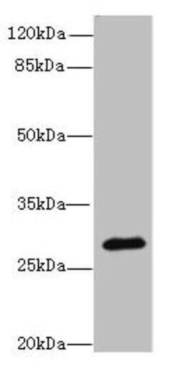 Invitrogen CAPNS2 Polyclonal Antibody 100 &mu;g; Unconjugated:Antibodies,