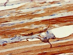 Invitrogen PLIN4 Polyclonal Antibody 100 &mu;g; Unconjugated:Antibodies,