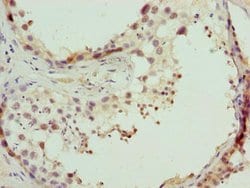 Invitrogen CPXCR1 Polyclonal Antibody 100 &mu;g; Unconjugated:Antibodies,