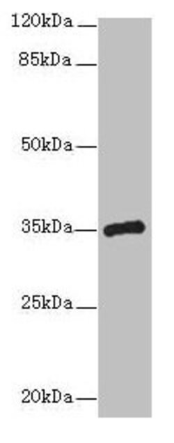 Invitrogen CPXCR1 Polyclonal Antibody 100 &mu;g; Unconjugated:Antibodies,