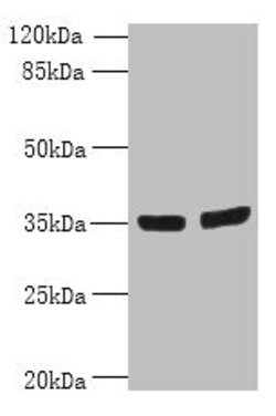 Invitrogen OSR2 Polyclonal Antibody 100 &mu;g; Unconjugated:Antibodies,