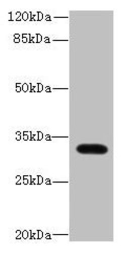 Invitrogen LIX1 Polyclonal Antibody 100 &mu;g | Buy Online | Invitrogen&trade; | Fisher Scientific