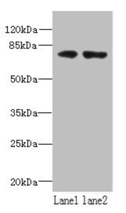 Invitrogen WDTC1 Polyclonal Antibody 100 &mu;g; Unconjugated:Antibodies,