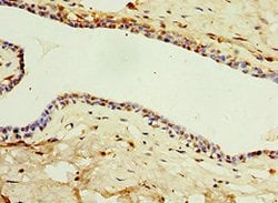 Invitrogen IL-22 Receptor alpha Polyclonal Antibody 100 μL; Unconjugated:Antibodies,