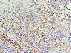 Invitrogen IL-22 Receptor alpha Polyclonal Antibody 100 μL; Unconjugated:Antibodies,