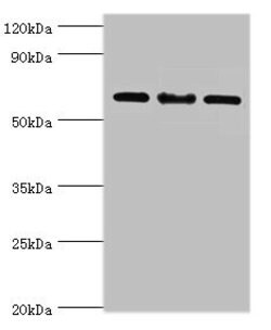 Invitrogen IL-22 Receptor alpha Polyclonal Antibody 100 μL; Unconjugated:Antibodies,