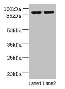 Invitrogen EFHB Polyclonal Antibody 100 &mu;g; Unconjugated:Antibodies,