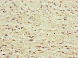 Invitrogen NEDD1 Polyclonal Antibody 100 &mu;L; Unconjugated:Antibodies,