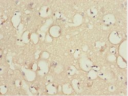 Invitrogen KBTBD7 Polyclonal Antibody 100 &mu;L; Unconjugated:Antibodies,