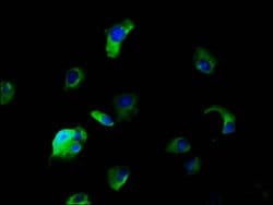 Invitrogen SLC5A5 Polyclonal Antibody 100 μg; Unconjugated:Antibodies,