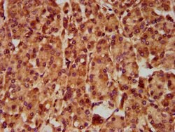 Invitrogen SLC5A5 Polyclonal Antibody 100 μg; Unconjugated:Antibodies,