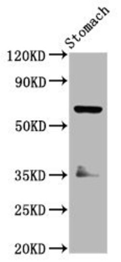 Invitrogen SLC5A5 Polyclonal Antibody 100 μg; Unconjugated:Antibodies,