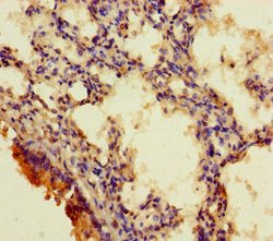 Invitrogen RGMA Polyclonal Antibody 100 μg; Unconjugated:Antibodies,