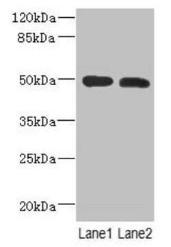 Invitrogen RGMA Polyclonal Antibody 100 μg; Unconjugated:Antibodies,