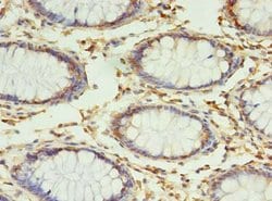 Invitrogen RPUSD4 Polyclonal Antibody 100 &mu;g; Unconjugated:Antibodies,