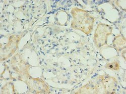Invitrogen RPUSD4 Polyclonal Antibody 100 &mu;g; Unconjugated:Antibodies,