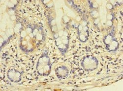 Invitrogen GALNT14 Polyclonal Antibody 100 μg; Unconjugated:Antibodies,