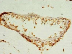 Invitrogen NUDT11 Polyclonal Antibody 100 &mu;g; Unconjugated:Antibodies,