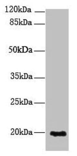 Invitrogen NUDT11 Polyclonal Antibody 100 &mu;g; Unconjugated:Antibodies,