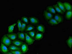 Invitrogen VPS39 Polyclonal Antibody 100 &mu;g; Unconjugated:Antibodies,