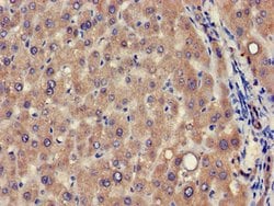 Invitrogen VPS39 Polyclonal Antibody 100 &mu;g; Unconjugated:Antibodies,