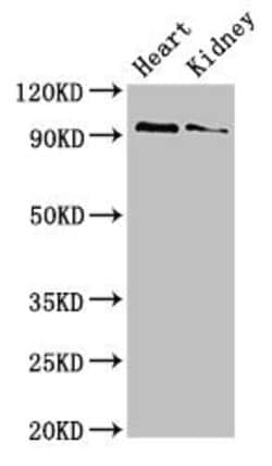 Invitrogen VPS39 Polyclonal Antibody 100 &mu;g; Unconjugated:Antibodies,
