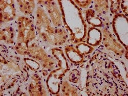 Invitrogen ACRC Polyclonal Antibody 100 &mu;g; Unconjugated:Antibodies,