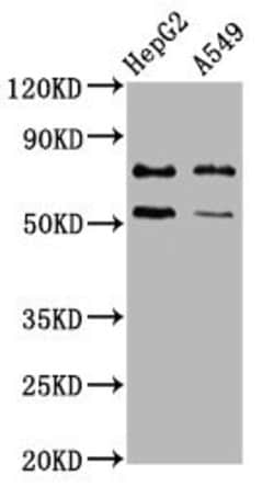 Invitrogen ACRC Polyclonal Antibody 100 &mu;g; Unconjugated:Antibodies,