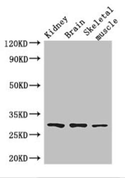 Invitrogen PLD6 Polyclonal Antibody 100 &mu;g; Unconjugated:Antibodies,