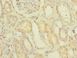 Invitrogen PDCL2 Polyclonal Antibody 100 &mu;g; Unconjugated:Antibodies,