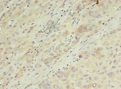 Invitrogen ARF7 Polyclonal Antibody 100 &mu;g; Unconjugated:Antibodies,