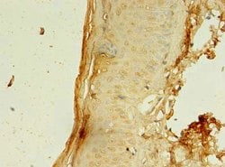 Invitrogen CCDC24 Polyclonal Antibody 100 &mu;g; Unconjugated:Antibodies,