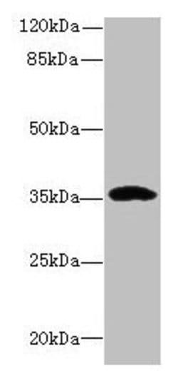 Invitrogen CCDC24 Polyclonal Antibody 100 &mu;g; Unconjugated:Antibodies,