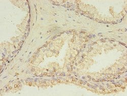 Invitrogen HDDC3 Polyclonal Antibody 100 μg; Unconjugated:Antibodies,