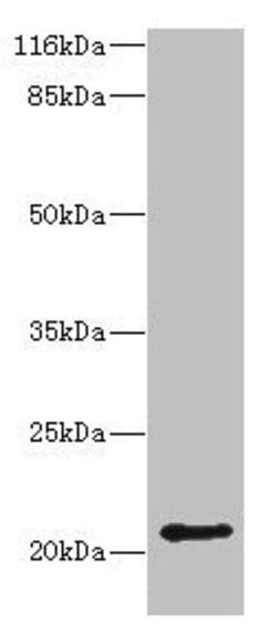 Invitrogen HDDC3 Polyclonal Antibody 100 μg; Unconjugated:Antibodies,