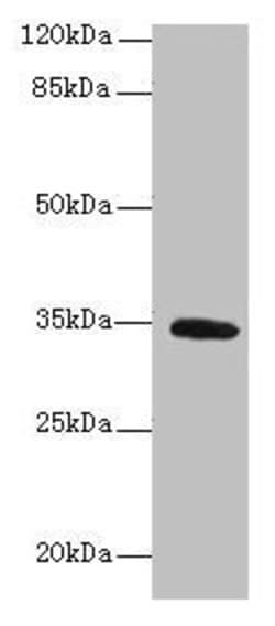 Invitrogen C5orf35 Polyclonal Antibody 100 μg; Unconjugated:Antibodies,