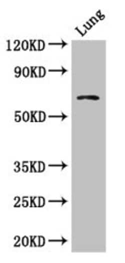 Invitrogen BBS1 Polyclonal Antibody 100 &mu;g; Unconjugated:Antibodies,